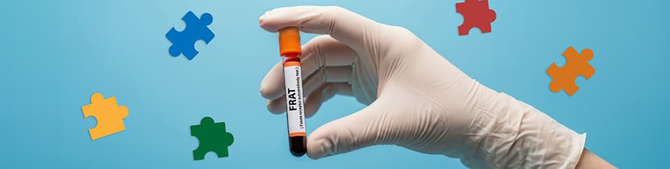 autism blood test